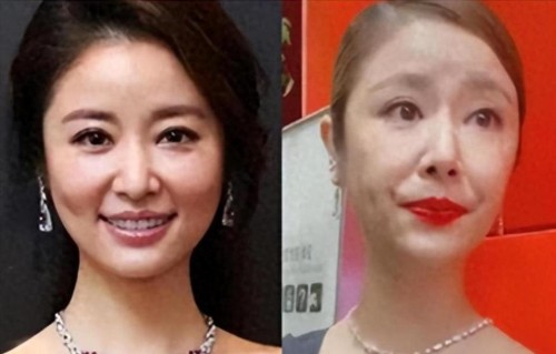 关美颜没法见人，赵丽颖老十岁，刘晓庆成大妈，张柏芝太离谱