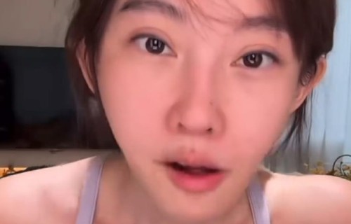 冯提莫承认整容：填充泪沟与黑眼圈，切双眼皮手术失败多次修复|公众|态度|素颜|主播