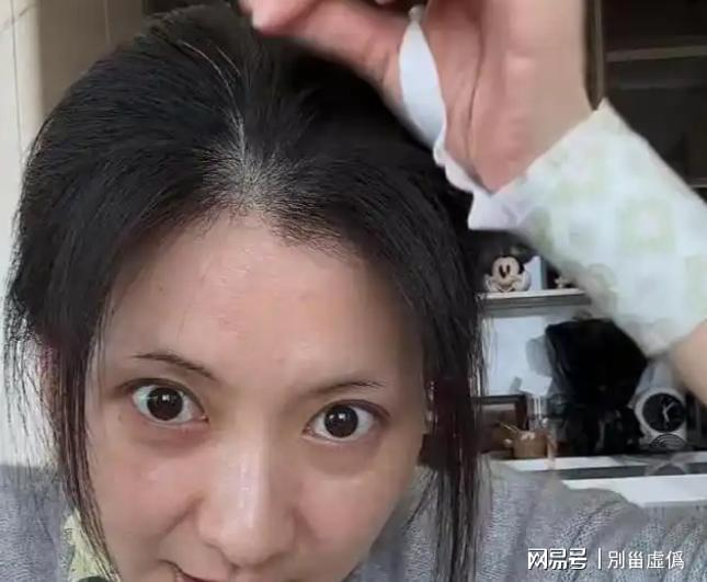  打开网易新闻 查看精彩图片 